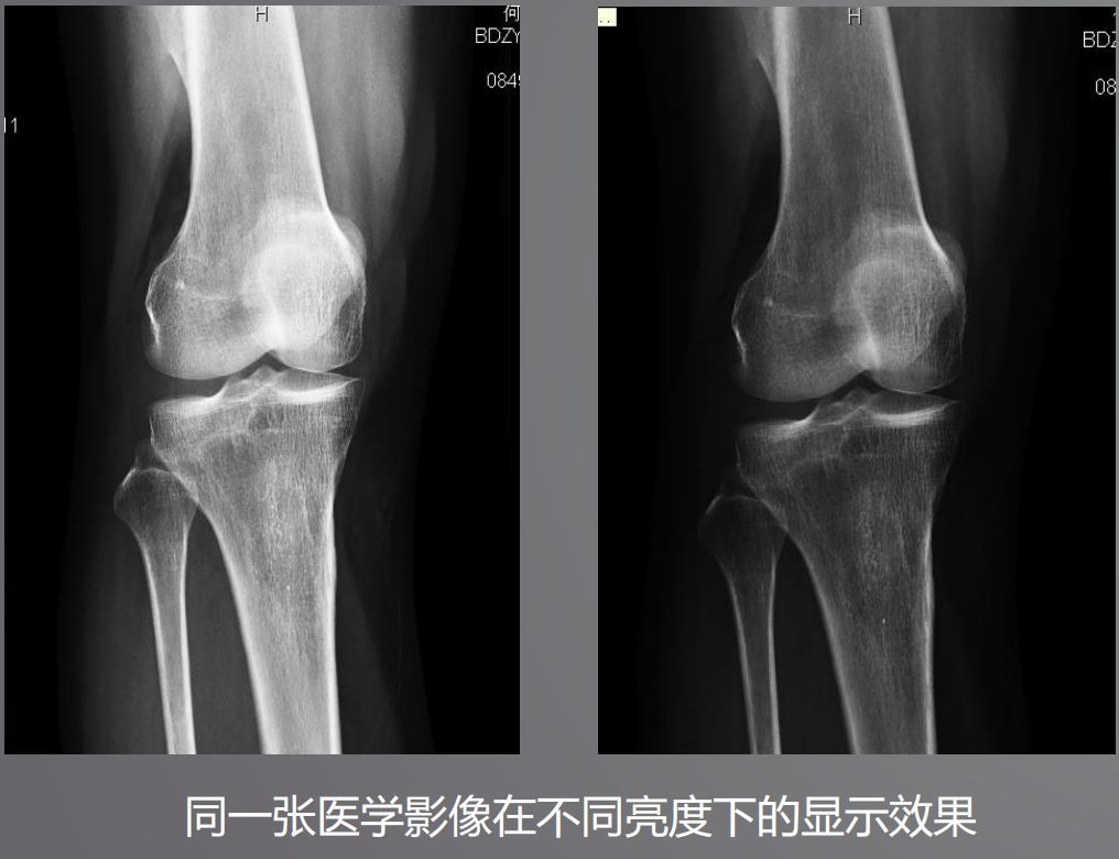 寵物DR設備的顯示器有要求？普通和醫(yī)用顯示器有什么區(qū)別